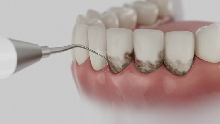 Reliable Dental Implants contractor in Erda, UT by Smile Center Dentistry